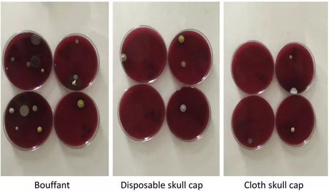 quantity of bacteria in the petri dishes